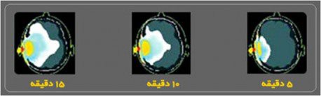 http://shapf.ir/files/GOD/mazerat/%D9%85%D8%B4%DA%A9%D9%84%D8%A7%D8%AA%20%D8%A7%D8%B3%D8%AA%D9%81%D8%A7%D8%AF%D9%87%20%D8%A7%D8%B2%20%D9%85%D9%88%D8%A8%D8%A7%DB%8C%D9%84.jpg
